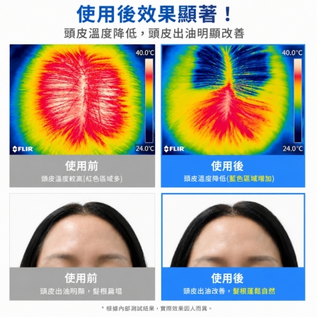 【韓國MED:ALL✨清爽頭皮降溫噴霧80ml】涼感乾洗髮｜頭皮降溫｜控油清爽｜頭皮鎮靜｜免洗頭噴霧